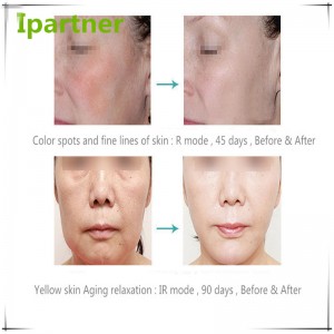 Bán nóng Thiết bị làm đẹp LED Photon trị liệu chăm sóc da