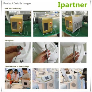 Ipartner LS980 Diode Laser làm giảm hệ thống đỏ
