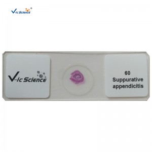100 bộ kit bệnh lý con người slide slide chuẩn bị kính hiển vi