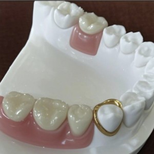 Đính kèm độ chính xác