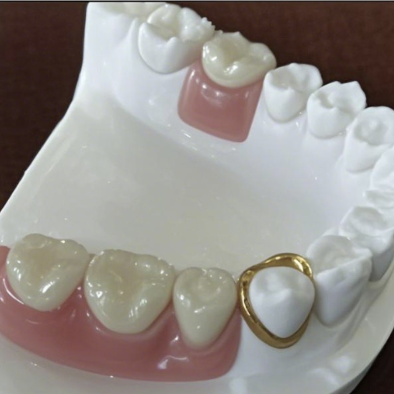 Đính kèm độ chính xác